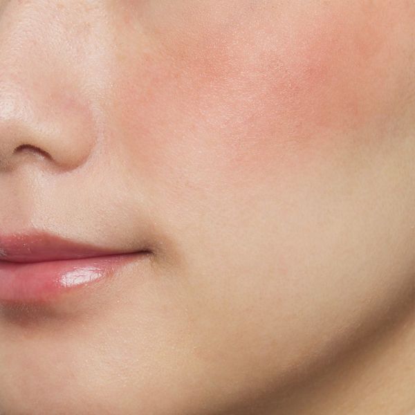 色白にも似合うブラウンベースのキス『パウダーチークス 06 Melancolie』をご紹介に関する画像8