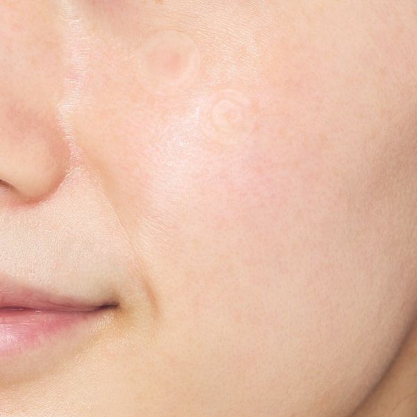 VT cosmetics(ブイティーコスメティックス)『プロシカ クリア スポットパッチ』の使用感をレポに関する画像10