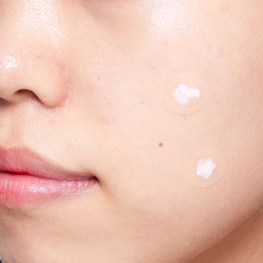 アクネスラボ 薬用 スポッツクリーム 【夜用ポイントパッチ付】 <医薬部外品> 7g の画像 1