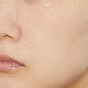 メディヒール ティーツリーケアソルーション アンプルマスクJEX 25ml×3枚 の画像 1