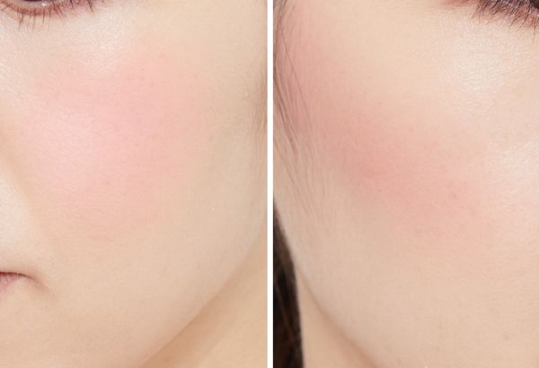 クリームチークの使い方をチェック!ツヤっと大人な血色感ある頬にの画像