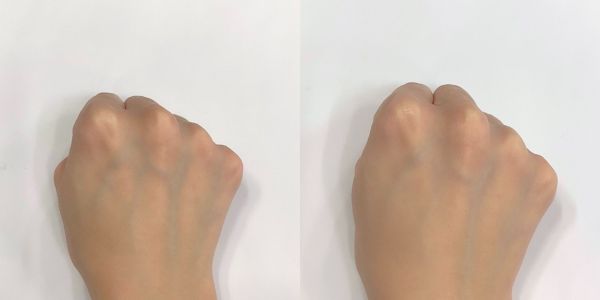 ルーセント(左:素肌 右:使用後)