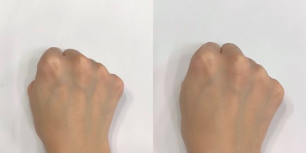 ライト(左:素肌 右:使用後)
