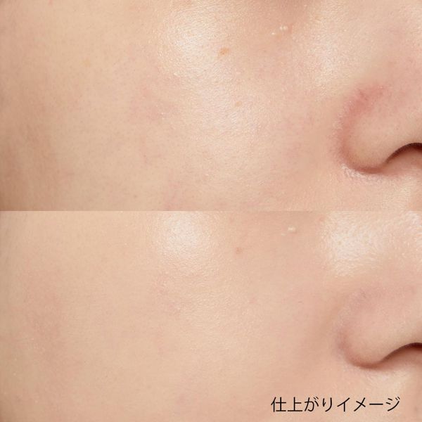 ノンコメドジェニックの効果とは? ニキビ肌に効果的なおすすめアイテム14選【医療監修】の画像