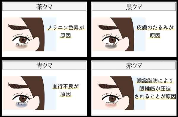 目のくまやたるみに おすすめの韓国のアイクリーム 厳選 Noin ノイン 目のくまやたるみに おすすめの韓国のアイクリーム 厳選 Noin ノイン