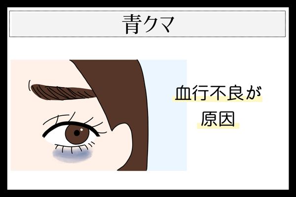 目の下のクマには種類がある? 見分け方や原因、種類別の対策を詳しく解説!の画像