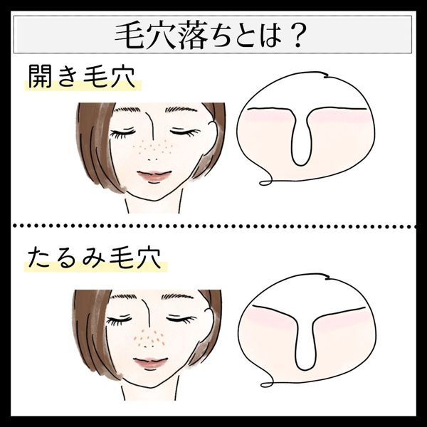 毛穴落ちしないファンデーションはどれ 毛穴落ちの原因やメイク方法まで徹底解説 Noin ノイン 毛穴落ちしないファンデーションはどれ 毛穴落ちの原因やメイク方法まで徹底解説 Noin ノイン