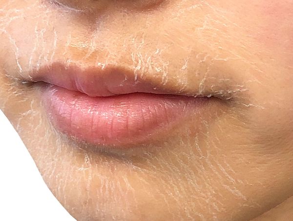 なんか最近、肌くすみが気になる。ずっと悩んでいる人は『〇〇〇〇マスク』使ってみて!の画像