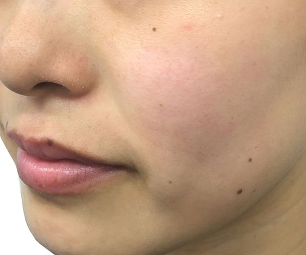 なんか最近、肌くすみが気になる。ずっと悩んでいる人は『〇〇〇〇マスク』使ってみて!の画像