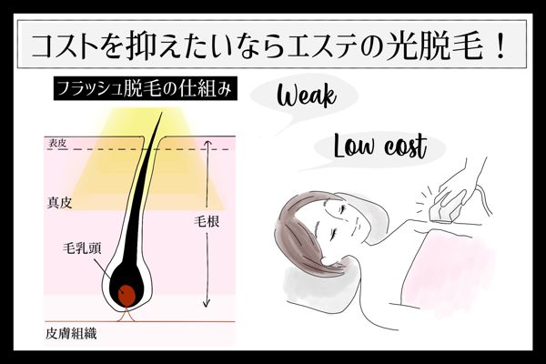 カミソリ 除毛クリーム 脱毛etc 自分に合ったムダ毛処理方法は 注意点やおすすめアイテムを紹介 医療監修 Noin ノイン