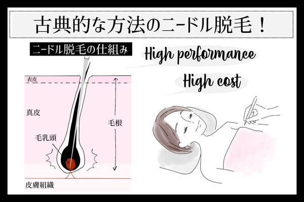 【セルフムダ毛処理】つるつる美肌でいるためのムダ毛処理の画像