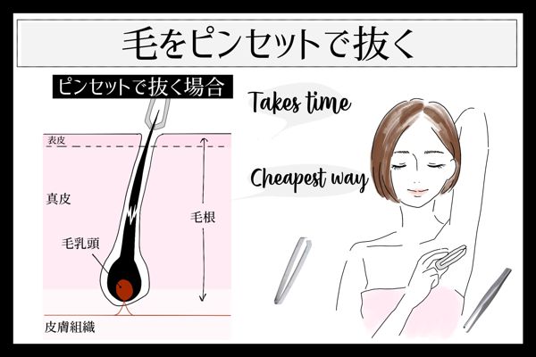 セルフムダ毛処理 つるつる美肌でいるためのムダ毛処理 Noin ノイン