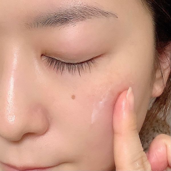 イハダの薬用バームがニキビや肌荒れにいいらしい 効果 成分 使い方まで徹底解説 口コミ付 Noin ノイン イハダの薬用バームがニキビや肌荒れにいいらしい 効果 成分 使い方まで徹底解説 口コミ付 Noin ノイン