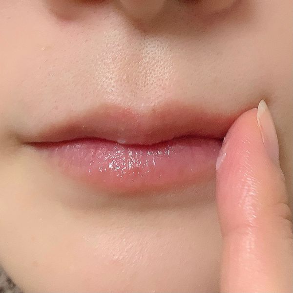 イハダの薬用バームがニキビや肌荒れにいいらしい 効果 成分 使い方まで徹底解説 口コミ付 Noin ノイン イハダの薬用バームがニキビや肌荒れにいいらしい 効果 成分 使い方まで徹底解説 口コミ付 Noin ノイン