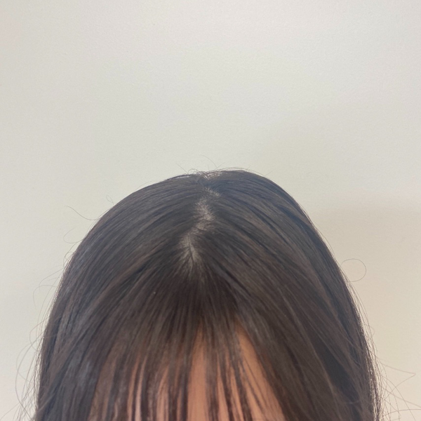 After